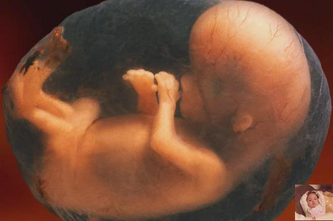 为什么羊水叫“羊水”而不是牛水、猪水、人